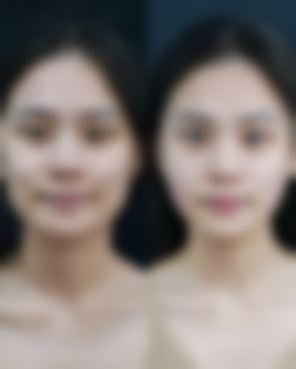 大连激光脱毛哪家医院好一点？大连医科大学附属一院和大连美琳达妇儿医院口碑好，价格合理 