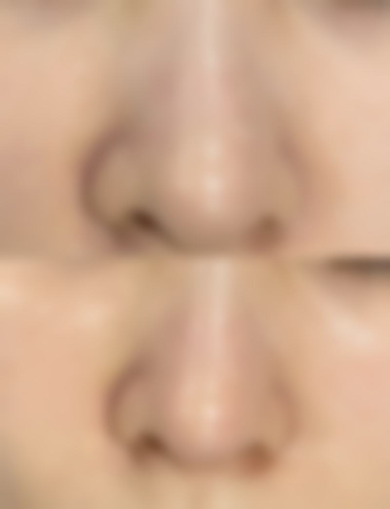 日常护理：预防和减轻眼袋的“基石”