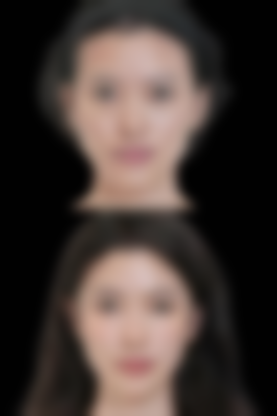 一院激光脱毛技术优势