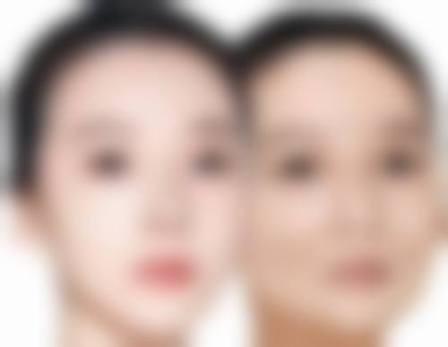 韩可旺馒化修复真人实例