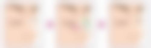 广州做八爪鱼紧缩术哪家医院做得好？广州建国与美莱技术优、口碑好，价格[X] - [X]元 