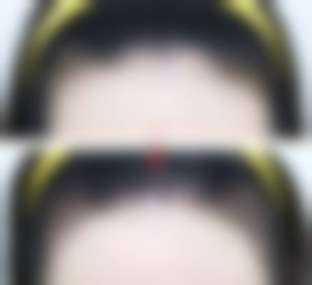 东莞雍禾医疗美容门诊部擅长项目