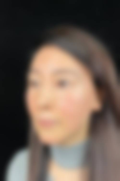 韩可旺馒化修复诊疗优势