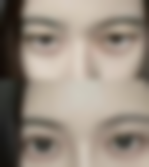 特殊情况:轻微胀痛与咀嚼无力的应对