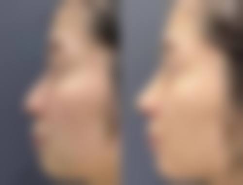 打了瘦脸针能吃什么水果？香蕉、猕猴桃、草莓等都是不错选择，助恢复又补充营养！ 