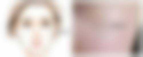 怎么能除掉疤痕疙瘩？手术、激光、药物治疗都有效，真实案例证明可行！ 