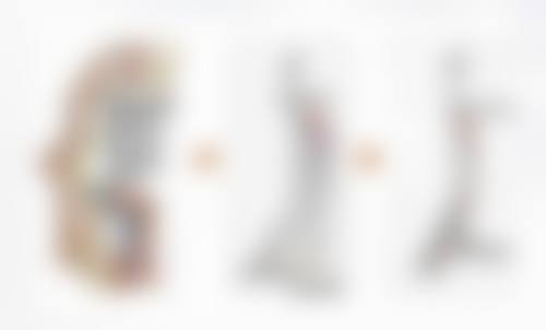 放射治疗：减少成纤维细胞，抚平疤痕