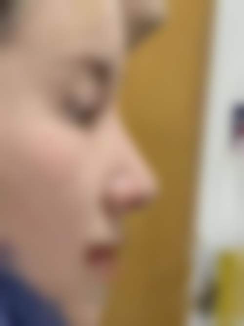 北京圣嘉荣医疗美容医院在线预约挂号：黄大勇医生亲诊，面部轮廓整形效果好，速来约！ 