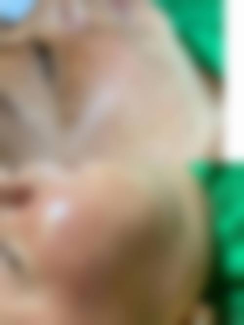 玻尿酸品牌十大排行榜及价格：盘点知名品牌价格区间，附真人体验感受与诊疗优势！ 