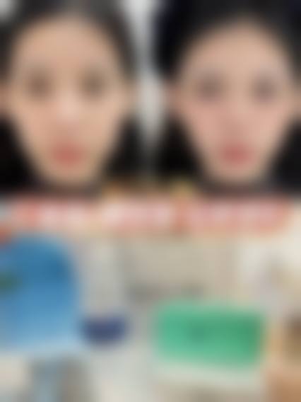 润百颜玻尿酸：多功能之选