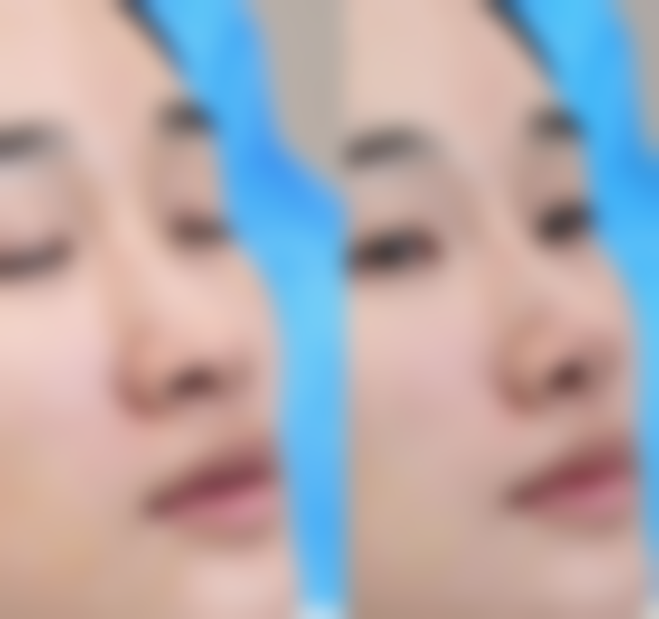 理想手术成效显著