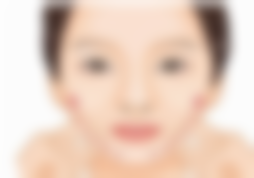 口碑佳的拉皮手术医院