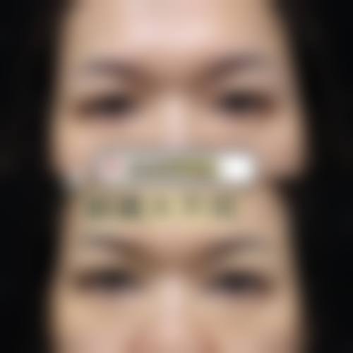 梅蔚德院长技术优势