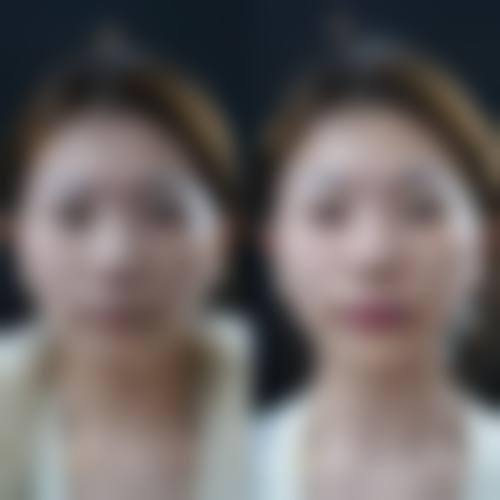 免费手术申请方式