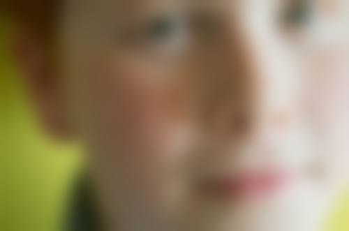 厦门华美医院祛斑特色