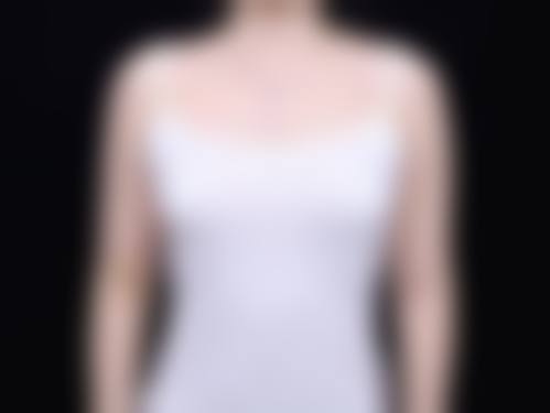 吴江山隆胸精良技术