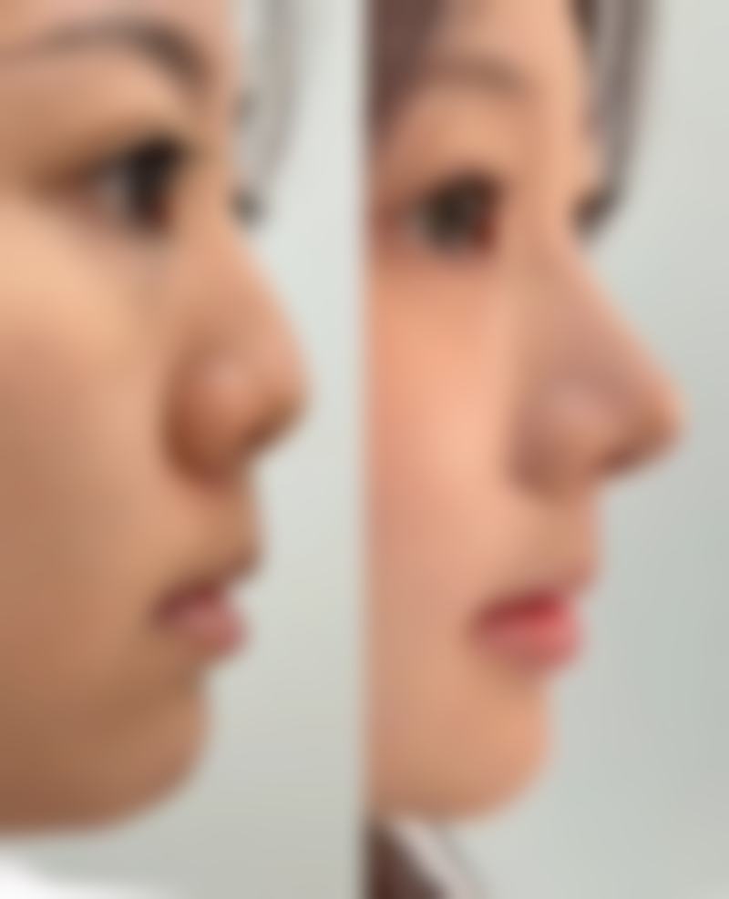 上海名颜整形医院项目清单