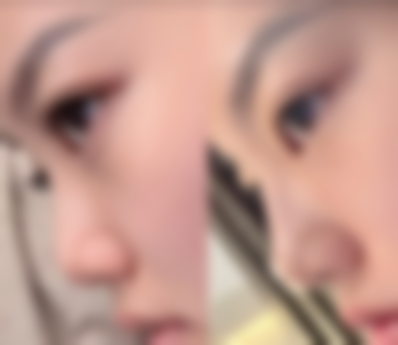 显著的手术成效