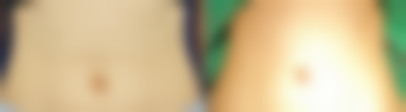 热门去眼袋眼霜成分大起底