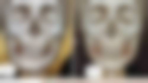 擅长的拇外翻项目