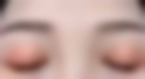 罗峰院长口碑评价及真人实例