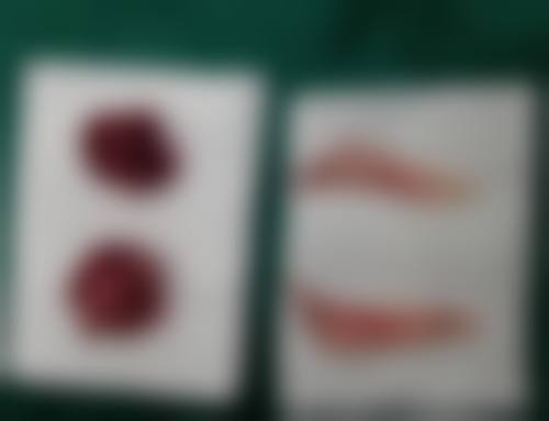 上海时光:专注整形磨骨出色