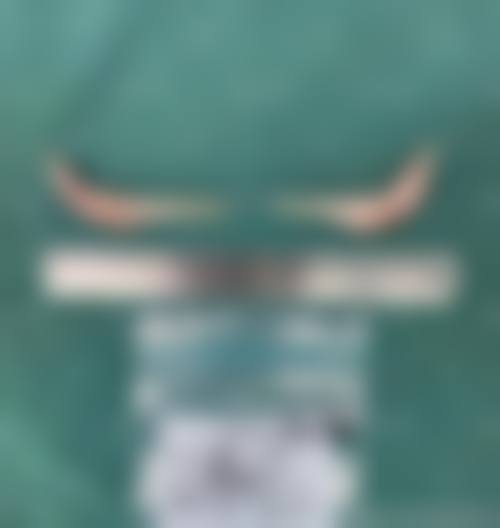 上海美联臣:国内外理念磨骨优选