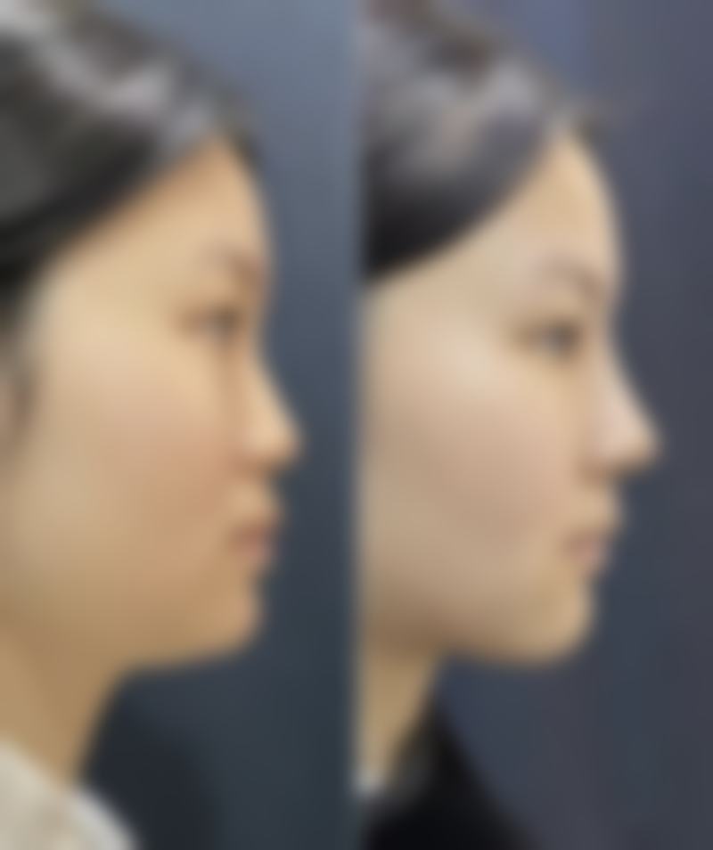 罗峰院长价格表