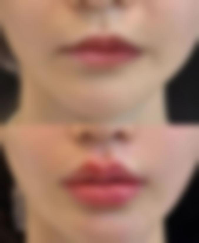 罗峰院长擅长项目