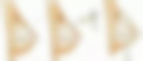 头发种植可以保持多久？一般10 - 20年，效果受体质、护理、技术影响，做好保养或能永久维持！ 