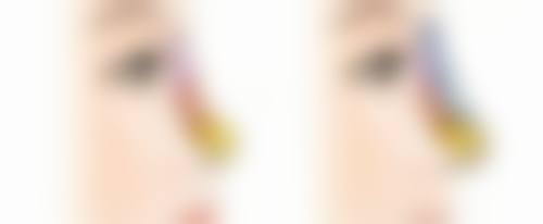 深圳美莱整形医院优势