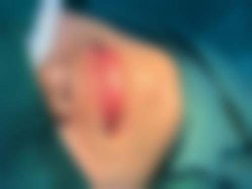 三亚市瑞希国内外医疗美容收费贵吗？