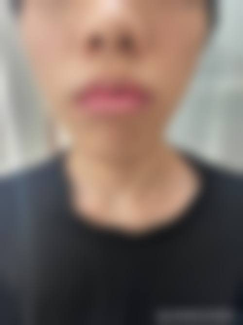 三亚市瑞希国内外医疗美容医院擅长什么？