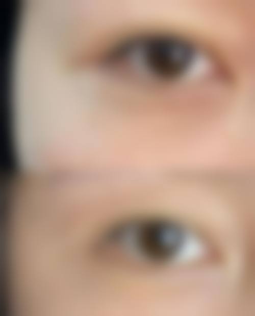 上海美莱：专精眼部修复