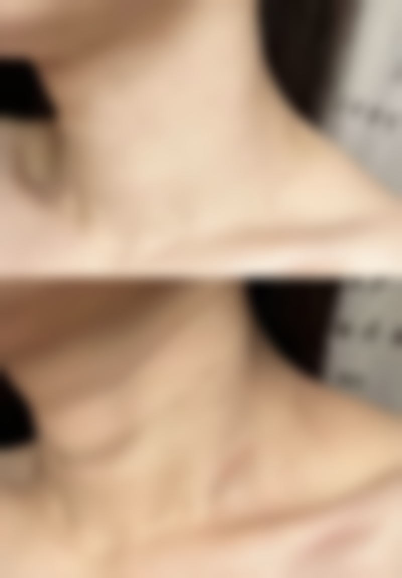 株洲伊百丽医疗美容诊所收费参考