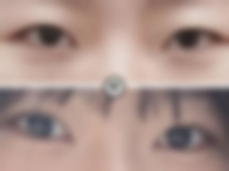 吕方中医生在深圳哪家整形医院看的好？深圳美莱整形医院，口碑好技术优，预约电话 0755-xxx ！ 