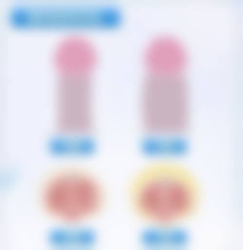 孩子身上的疤痕什么时间修复最好？功能受影响应及时手术，外观问题幼儿园或小学入学前较合适！ 