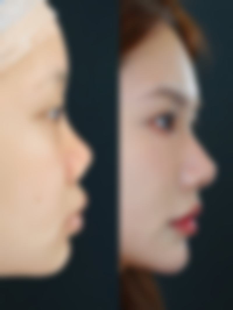 龙文碧湖新医美医疗美容诊所收费价格表