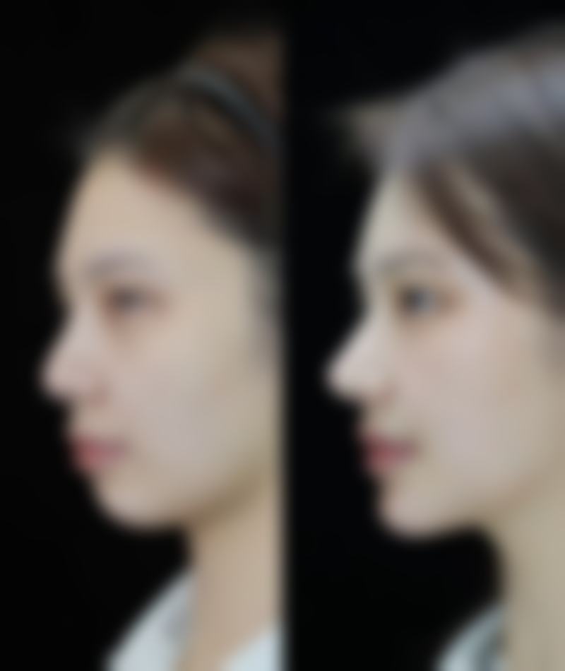 长沙半岛整形医学美容医院价格与联系方式