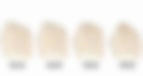 疤痕疙瘩化脓如何治愈？先控制感染，再管理疤痕，多数感染1 - 2周可缓解！ 