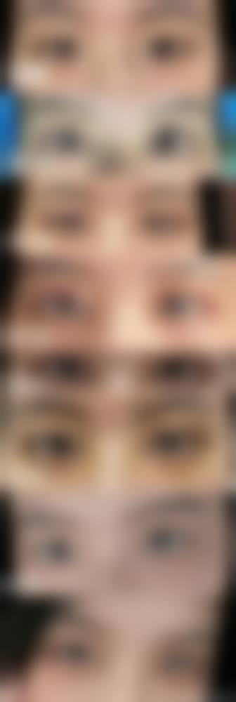 甘肃兰天整形美容门诊部医院擅长什么？