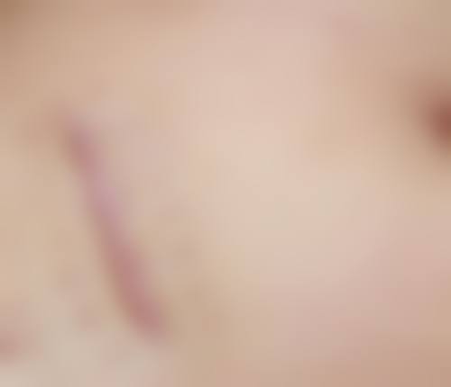 兴义紫辰辰美整形医院地址及营业时间