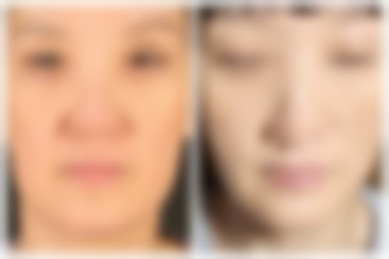 注意事项：治愈路上的小秘诀