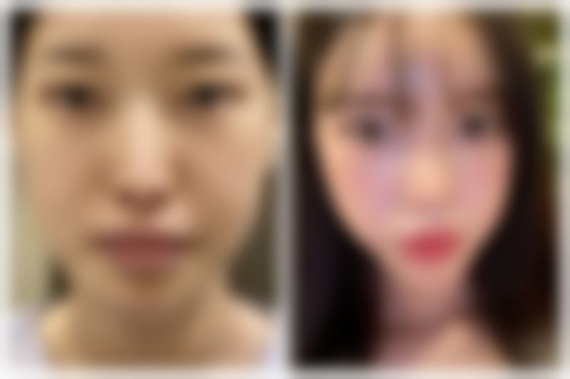 控制感染：治疗的第一步