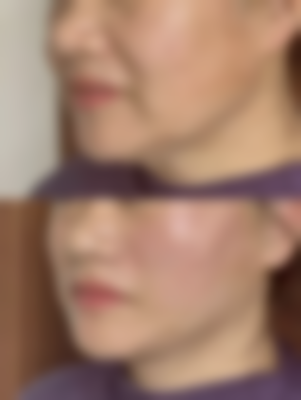 欧莱美医院：专精微整与皮肤美容