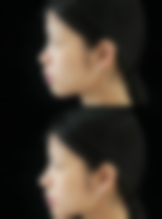 哈尔滨三甲医院整容外科哪家好？哈医大一院杨学财等专家，技术优口碑好，可官网预约！ 