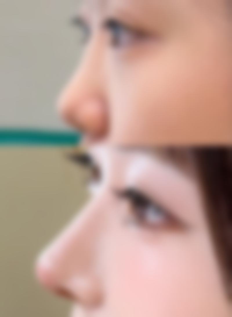 哈医 大一院其他信息