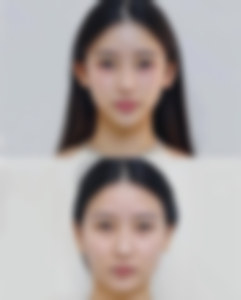 深圳做私处整形好的医院，美莱和阳光值得选！技术先进口碑好，收费3000 - 20000元 ｜ 电话0755 - 8323xxx、0755 - 8211xxx 