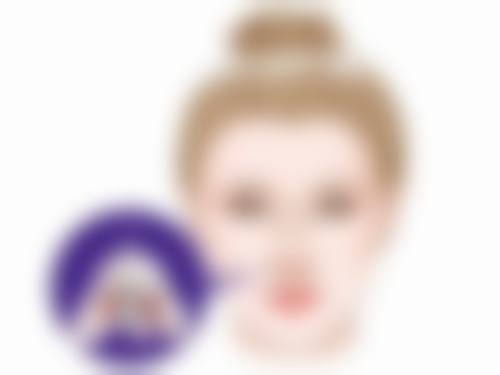 双眼皮二次手术的风险与应对策略