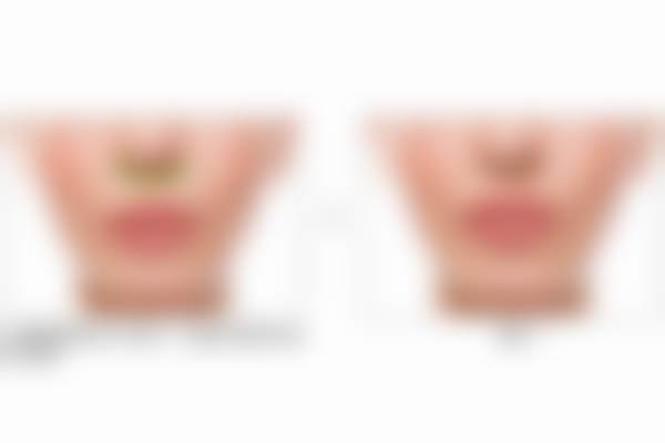 翟宇东医生的口碑评价